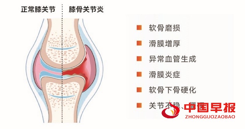 1762854342845999.jpg 1_副本.jpg